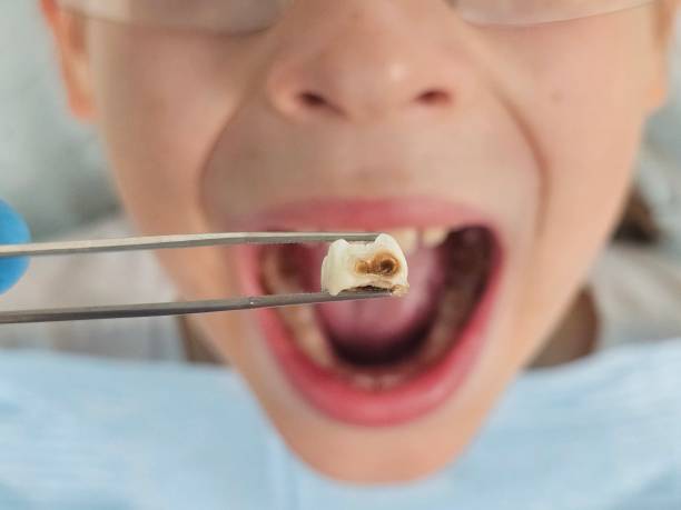Best Emergency Treatment for Toothache in North Chicago, IL